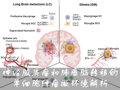 【烈冰助力】神經膠質瘤和肺癌腦轉移的單細胞腫瘤微環境解析